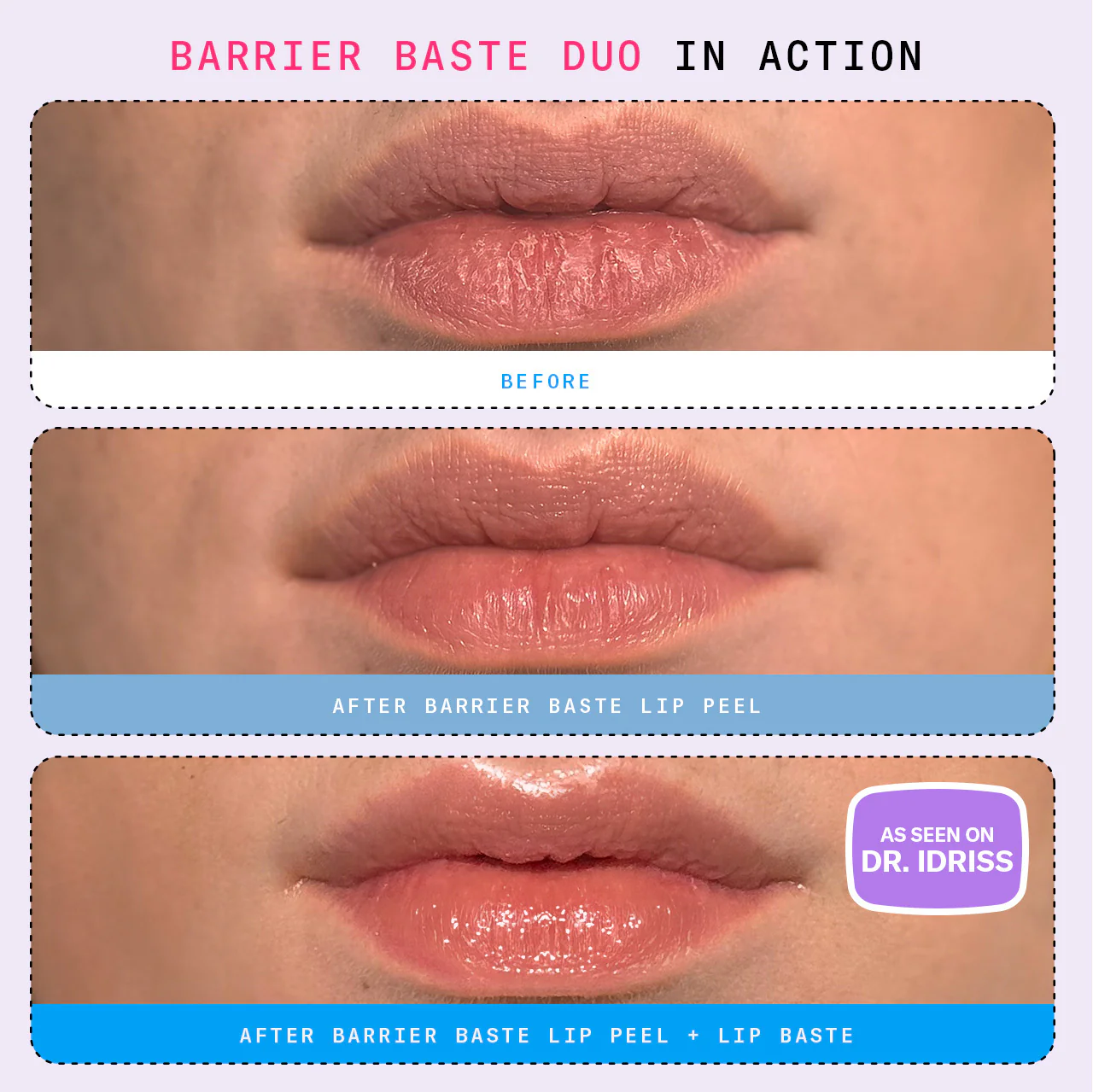Barrier Baste Lip Peel - Image 7