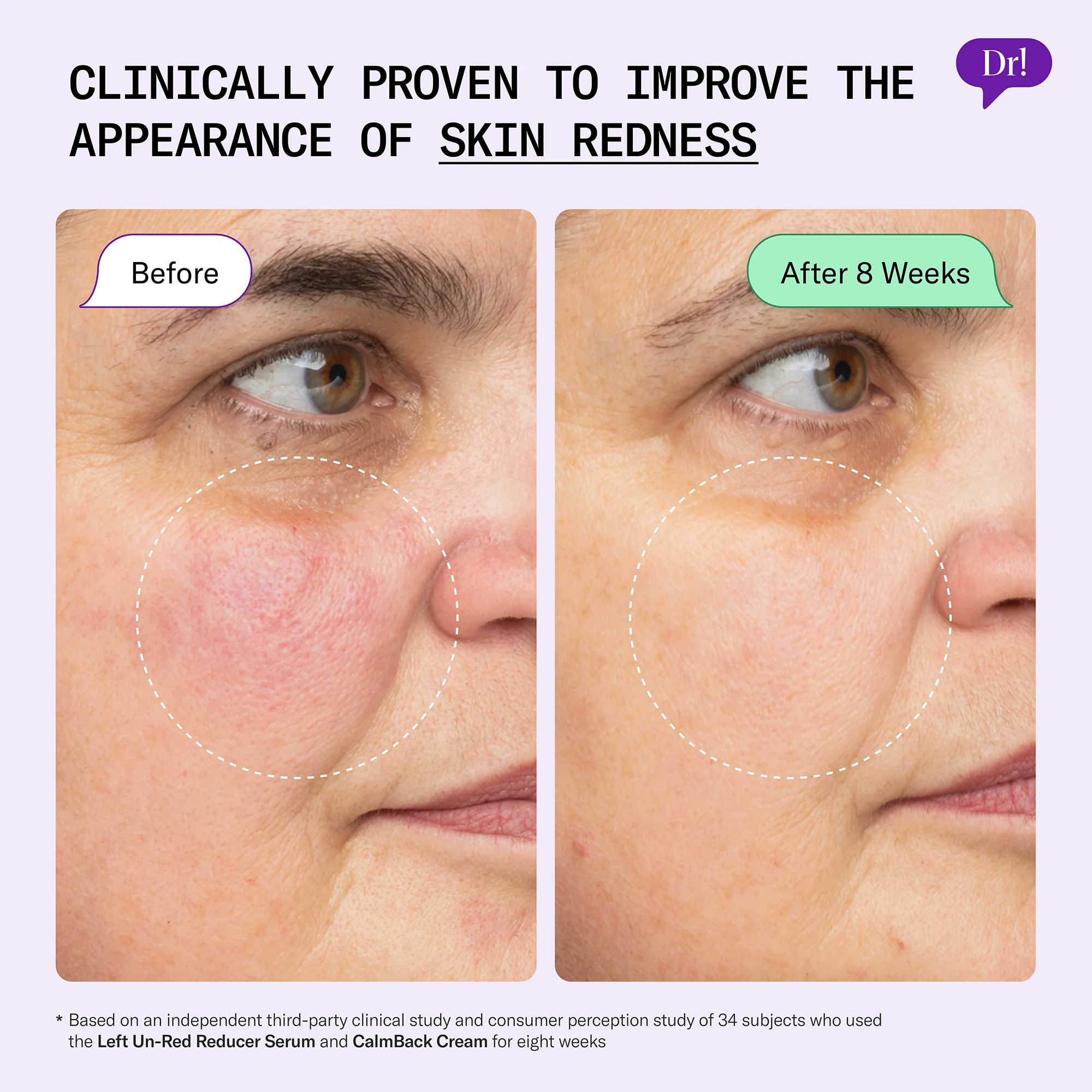 Left Un-Red Reducer Serum - Image 3